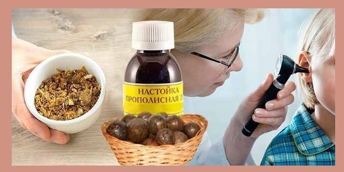 Адгезивний отит середнього вуха: рекомендації, як лікувати