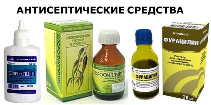 Хвороби горла та гортані - грибкові. бактеріальні, вірусні