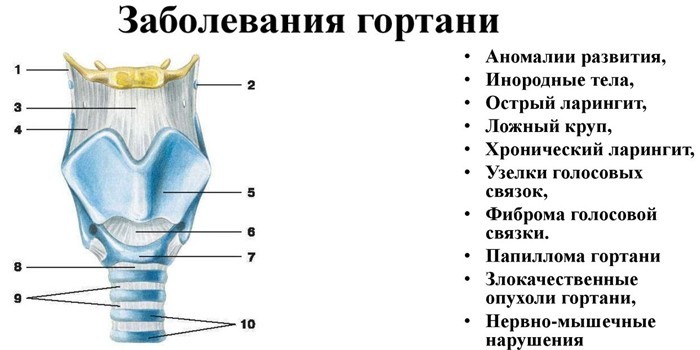 Хвороби горла та гортані - грибкові. бактеріальні, вірусні