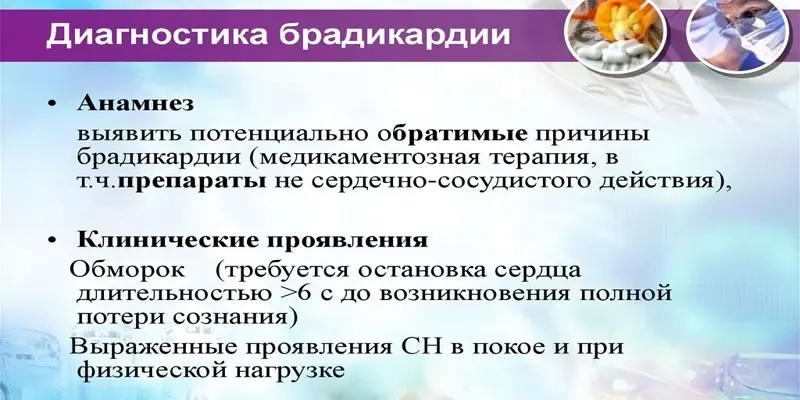 Лікування брадикардії при гіпертонії - долікарська допомога, лікарські препарати та профілактика