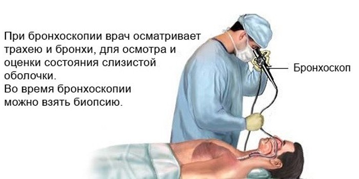 Бронхоскопія дорослій і дитині - як роблять дослідження
