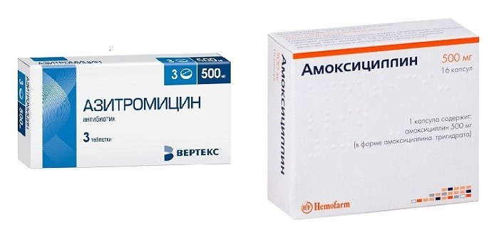 Чирьи - що це таке, лікування фурункульозу в домашніх умовах та у лікаря