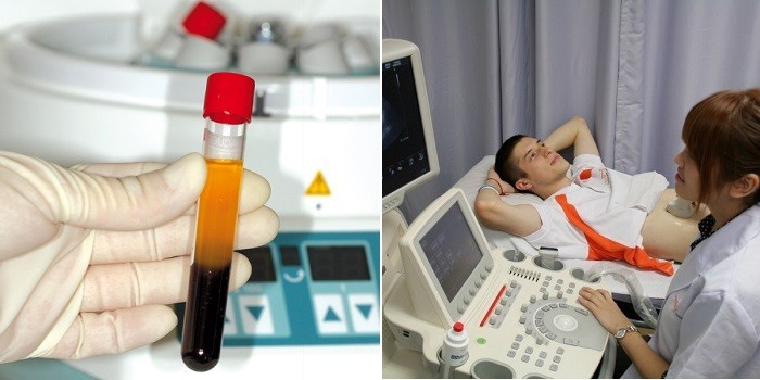 Що таке баланіт і як його лікувати