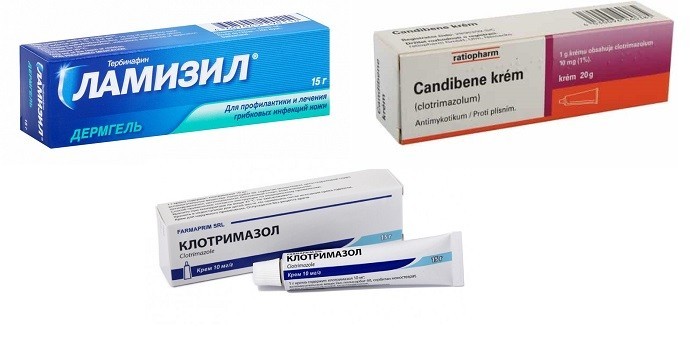 Що таке баланіт і як його лікувати