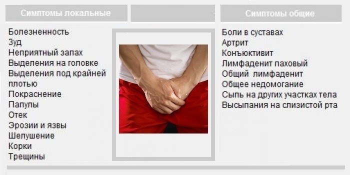 Що таке баланіт і як його лікувати