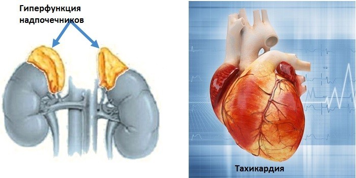 Дерматоміозит: ознаки та клінічні рекомендації при хворобі Вагнера