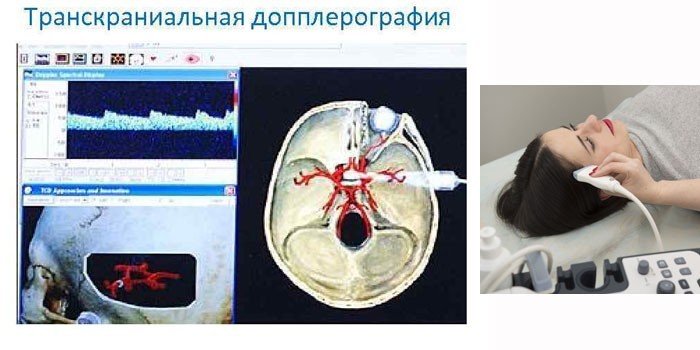 Доплерографія судин у дітей та дорослих - як роблять обстеження