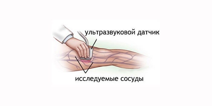 Доплерографія судин у дітей та дорослих - як роблять обстеження