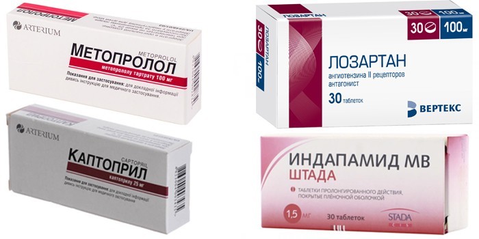 Гіпертонія 2 ступеня - як лікувати медикаментами та народними засобами
