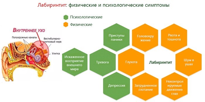 Гнійний отит гострий та хронічний – ознаки та як лікувати в домашніх умовах