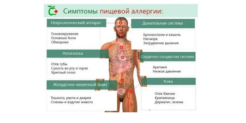 Харчова алергія у дітей: як виявляється, чим лікувати
