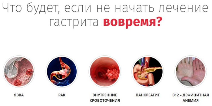 Як лікувати хронічний атрофічний гастрит