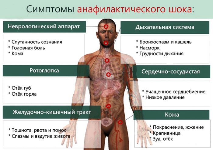 Кропив'янка на обличчі, руках і тілі — чому з'являється і як виглядає висипка
