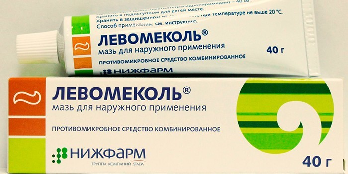 Лікування бартолініту в домашніх умовах гострого та хронічного