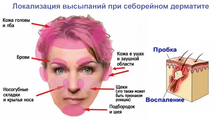 Лікування шкірних захворювань голови у людини