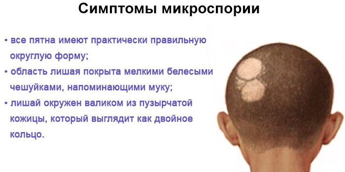 Лікування шкірних захворювань голови у людини