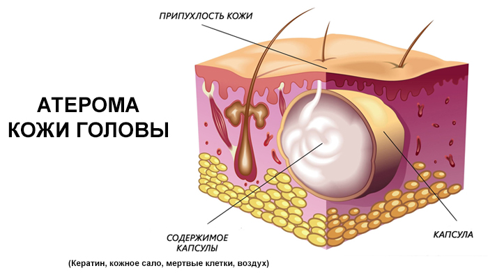 Лікування шкірних захворювань голови у людини