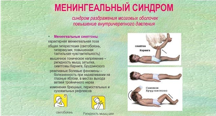 Лікування менінгіту у дорослих, симптоми та наслідки