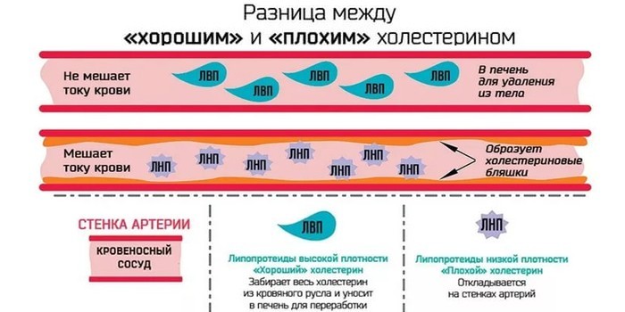 Ліпідограма - що показує, норми у дітей та дорослих