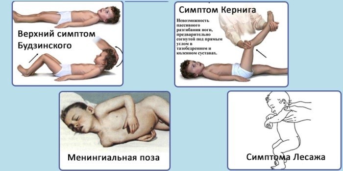 Менінгіт у новонароджених - ознаки, стадії та методи лікування