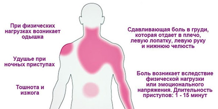 Нестабільна стенокардія - класифікація за Браунвальдом, діагностика та терапія