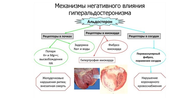 Первинний гіперальдостеронізм: клінічні рекомендації та діагностика