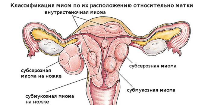 Причини болю у спині