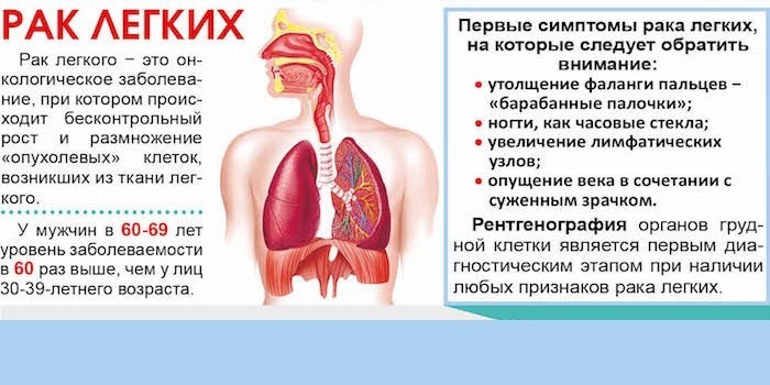 Ознаки раку легенів на ранніх та пізніх стадіях