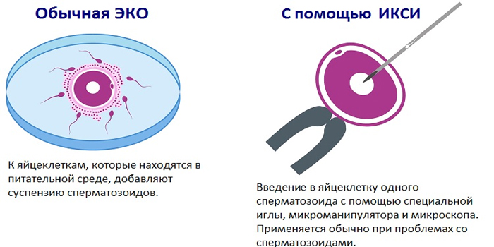 Протокол екстракорпорального запліднення у природному циклі