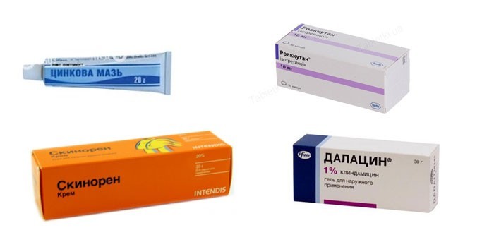 Прищі на підборідді: що означають і як позбавитися проблеми