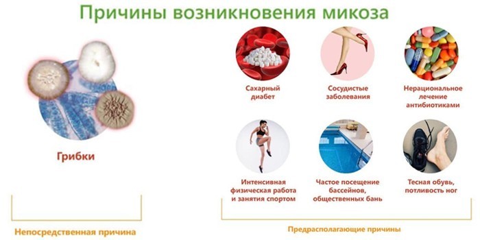 Симптоми та види мікозів шкіри людини