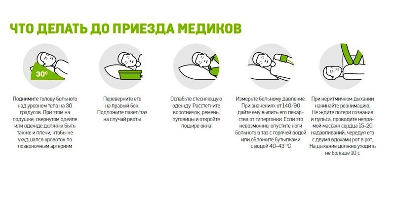 Симптоми мікроінсульту у чоловіка: причини та наслідки хвороби