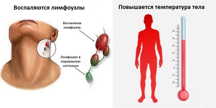 Симптоми отиту середнього вуха гострого та хронічного