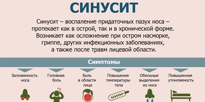Синусит гострий та хронічний – ознаки, діагностика та як лікувати