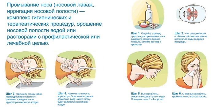 Синусит гострий та хронічний – ознаки, діагностика та як лікувати