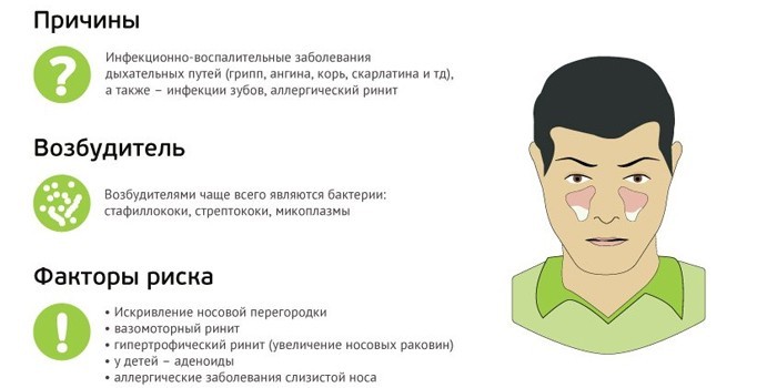 Синусит гострий та хронічний – ознаки, діагностика та як лікувати