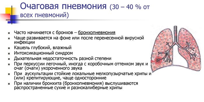 Позалікарняна пневмонія - симптоми, лікування та профілактика