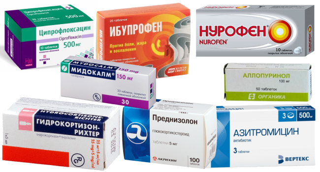 Запалення синовіальної сумки суглоба