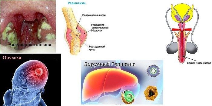 Висока температура без симптомів у дорослого – чому тримається і чим збивати