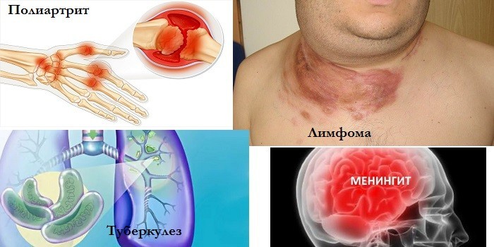 Висока температура без симптомів у дорослого – чому тримається і чим збивати