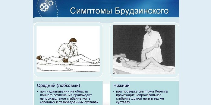 Чи заразен менінгіт - шляхи передачі інфекції у дітей та дорослих