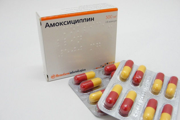 Болить ясна над зубом при натисканні, причини болю при натисканні