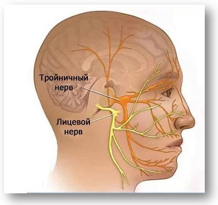 Болить зуб без нерва: чи можуть хворіти мертві зуби, що робити