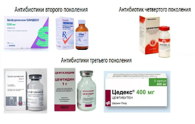 Чи боляче видаляти зуб мудрості: де болючіше виривати (зверху чи знизу), відгуки