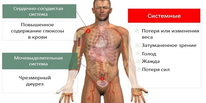 Часті сечовипускання у чоловіків – причини фізіологічні та патологічні, супутні прояви