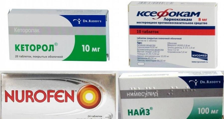 Як швидко позбавитися зубного болю: чим швидко прибрати, ефективні засоби