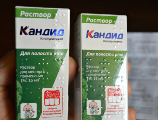 Лікування кандидозу ротової порожнини, чим лікувати молочницю в роті у дорослих