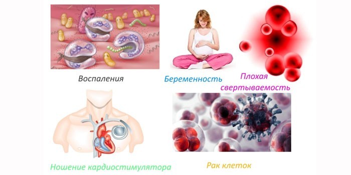 Магнітотерапія - принцип дії, користь та шкода, види апаратів