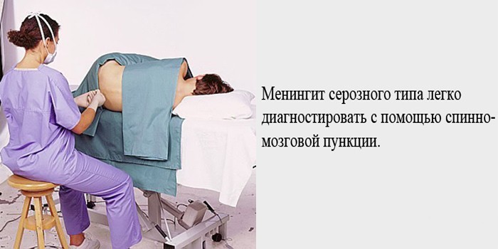 Менінгіт – симптоми та лікування етіотропне, патогенетичне, симптоматичне