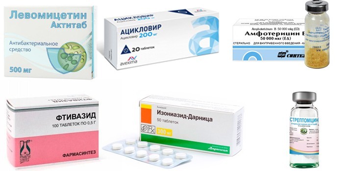 Менінгіт – симптоми та лікування етіотропне, патогенетичне, симптоматичне